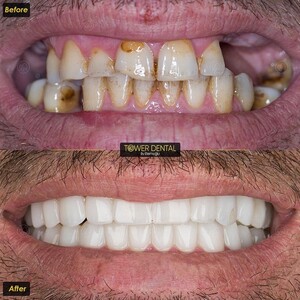 Image of Tower Dental Clinic Gallery 0