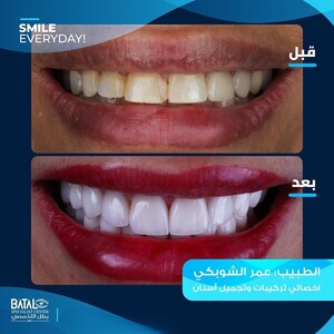 Image of Batal Dental Clinic Gallery 0