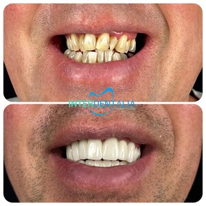 Image of InterAntalia Dental Clinic Gallery 2