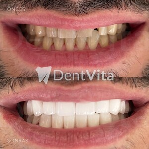 Image of DentVita Dental Clinic Gallery 1