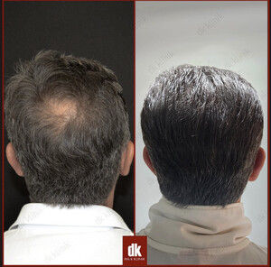 Image of DK Hair Klinik Gallery 1