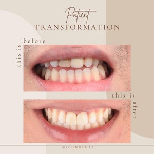 Image of Dental treatment before and after