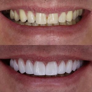 Image of Atk Dentpark Clinic Antalya Gallery 3