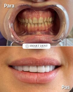 Image of Dental treatment before and after