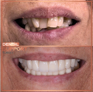 Image of Dental Support Turkey Gallery 2