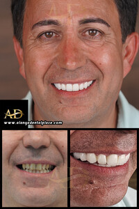 Image of Alanya Dental Place Gallery 0