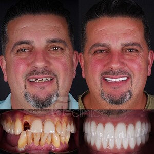 Image of Dental Excellence Turkey Gallery 1