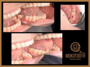 Image of Mokotooth Prestige Dental Gallery 2