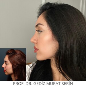 Image of Ph.Gediz Murat Serin Gallery 2