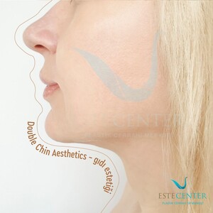 Image of Estecenter Plastic Surgery Center Gallery 3