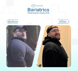 Image of Bariatric surgery