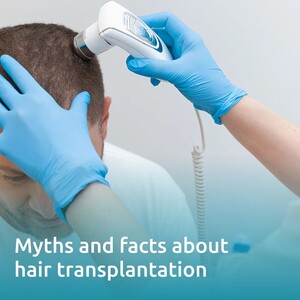 Image of Hair loss laser treatment - Nesterenko.md