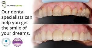 Image of Dental treatment - Pomadent