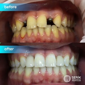 Image of Private Serik Oral and Dental Health Policlinic Gallery 2