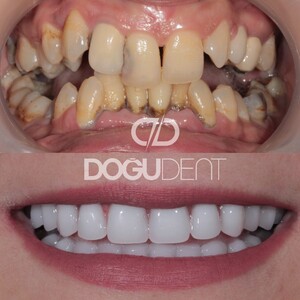 Image of DoğuDent Dental Clinic Gallery 2