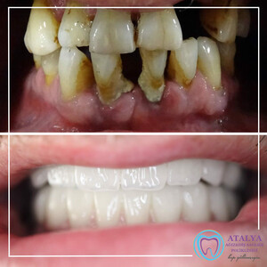 Image of Atalya Private Oral and Dental Health Polyclinic Gallery 3