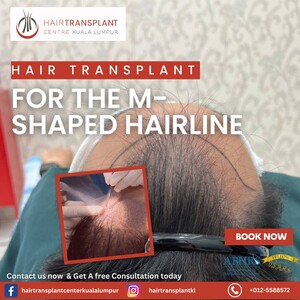 Image of Hair Transplant Kuala Lumpur Gallery 0