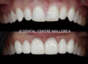 Image of Dental Centre Mallorca Gallery 0