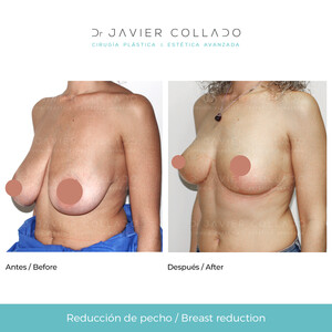 Image of Dr.Javier Collado Gallery 3