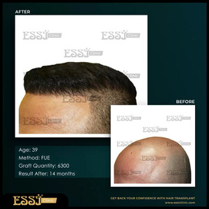 Image of Essi Hair Transplant Clinic Gallery 1