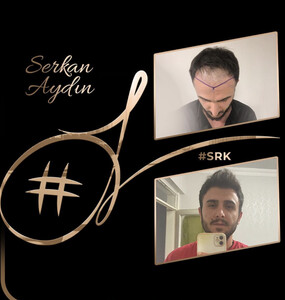 Image of Serkan Aydin Hair Clinic Gallery 2