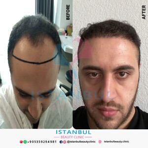 Image of Istanbul Beauty Clinic Gallery 3