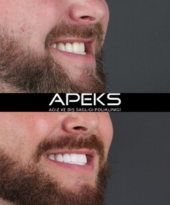 Image of Apeks Dental Clinic - Antalya Gallery 2