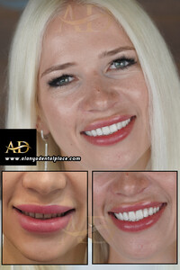 Image of Alanya Dental Place Gallery 3