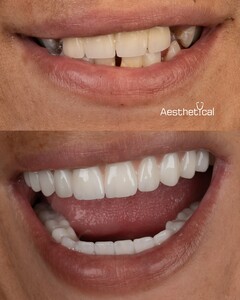 Image of Smile makeover - Aesthetical Clinic