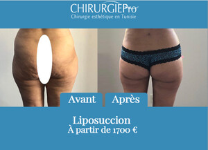 Image of ChirurgiePro - Chirurgie esthétique en Tunisie Gallery 3