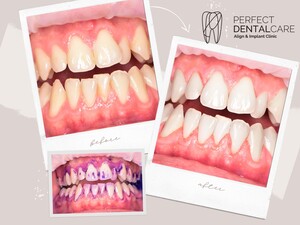 Image of Perfect Dental Care Gallery 0