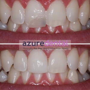 Image of Azure Dental Gallery 0