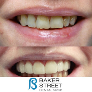 Image of Baker Street Dental Gallery 3