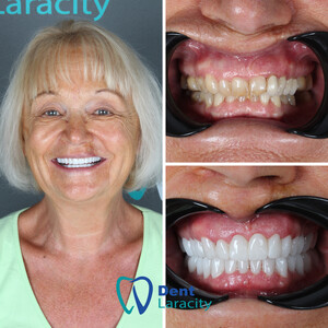 Image of Dent Laracity Dental Clinic Gallery 1