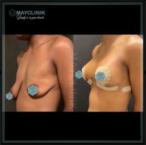 Image of MayClinik Plastic Surgery Gallery 3