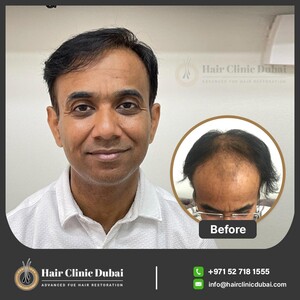 Image of The Hair Clinic Dubai Gallery 2