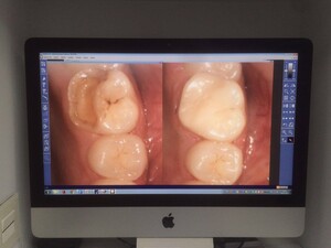 Image of Dental Deluxe Gallery 2