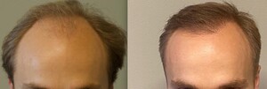 Image of Dr. Pyziak Hair Transplant Center Gallery 0