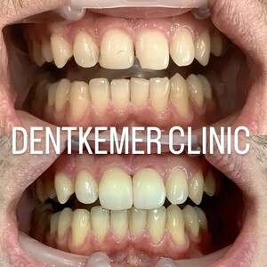 Image of Dentkemer Dental Clinic Gallery 1