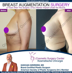 Image of Antalya Aesthetic and Plastic Surgery Gallery 3