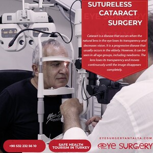 Image of Eye Surgery Antalya Gallery 0