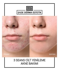 Image of Sade Derma Aesthetic Gallery 3