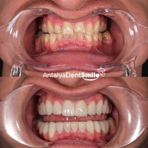 Image of Antalya Dent Smile Gallery 3