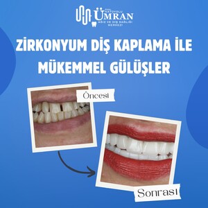 Image of Ümran Dental Center Gallery 0