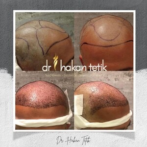 Image of Dr.Hakan Tetik Gallery 0