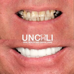 Image of Uncalı Dental Clinic Gallery 3