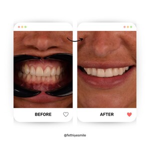 Image of Fethiye Smile Dental Clinic - Dentist Ali Oguzhan Dağ Gallery 0