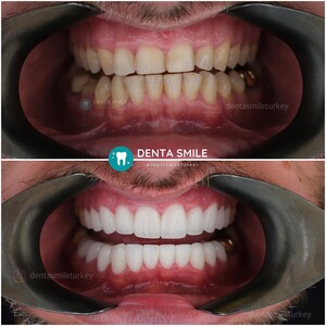 Image of DentaSmile Turkey Gallery 1