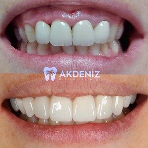 Image of Antalya Akdeniz Dental Clinic Gallery 1