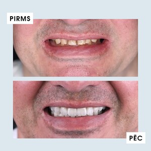 Image of Smile makeover - lava Dental